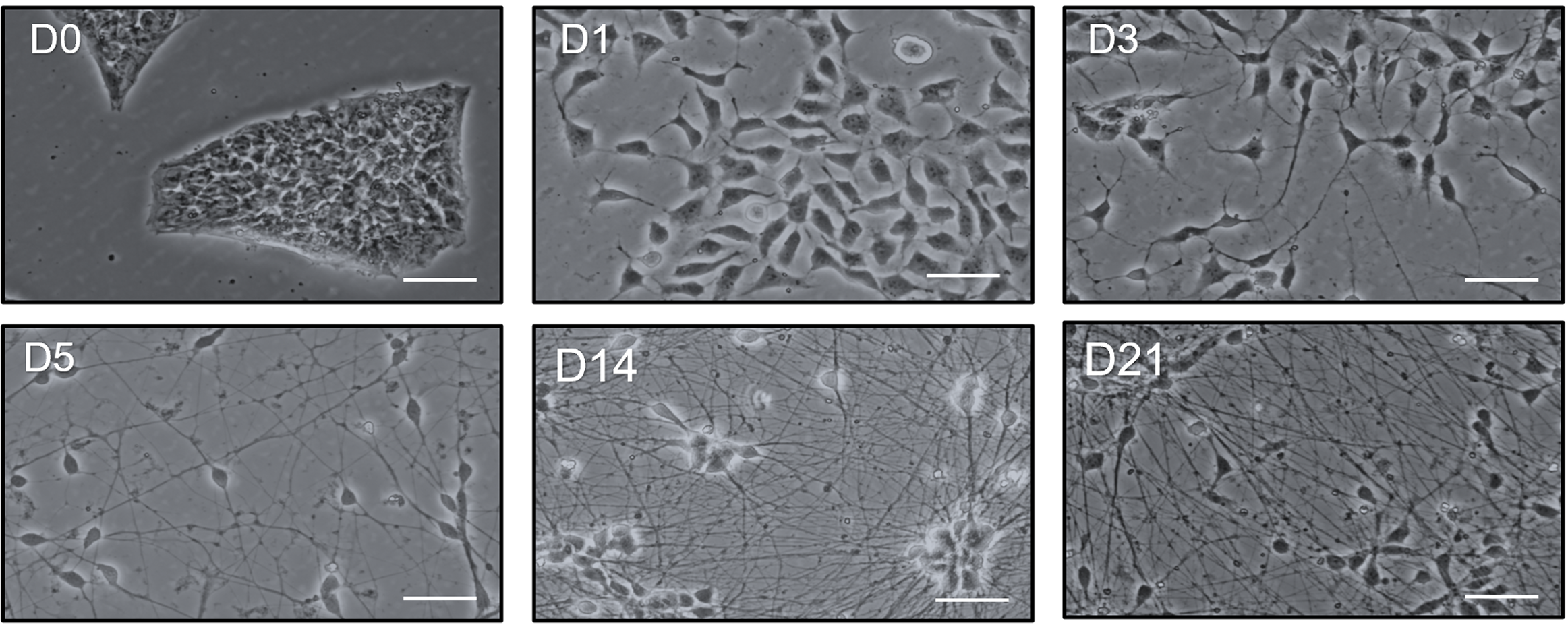 Six microscopy views showing iPSC-derived neuronal differentiation from day 0 to day 21